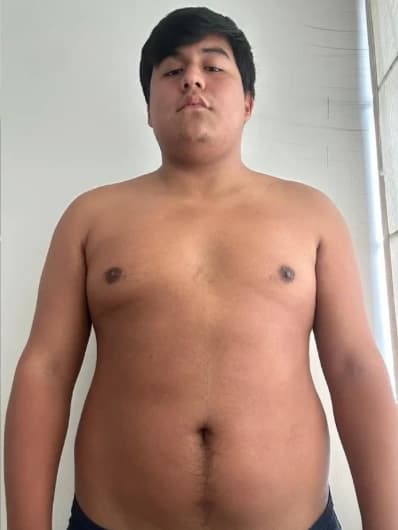 Antes del progreso de Raul, 21 años